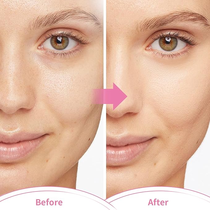 Ice face mask and silicone