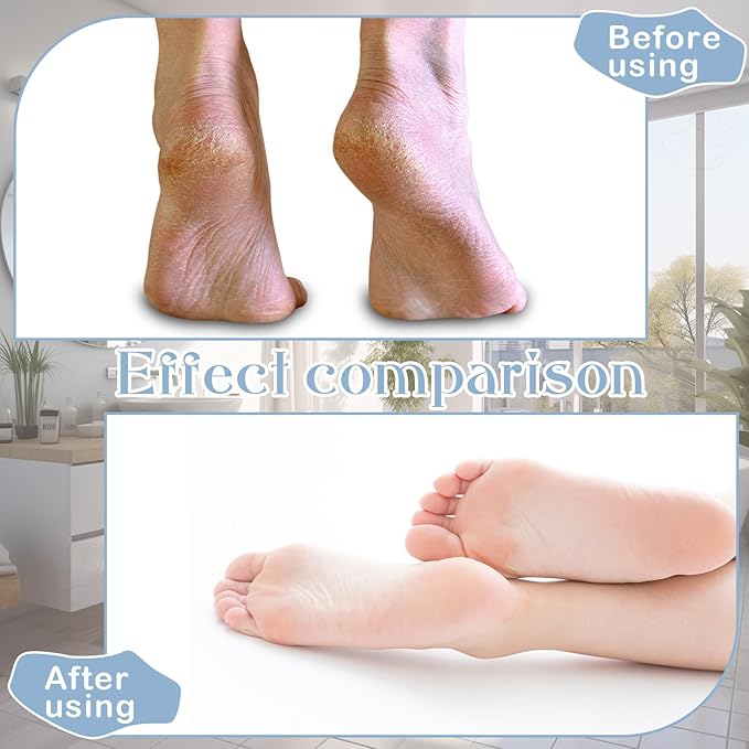 12 Pairs Moisturizing Socks Overnight for Dry Feet Cotton Spa Lotion Cotton Moisture Enhancing Cosmetic Moisturizing Socks for Women Men Foot Care Dry Cracked Feet(Nice,Pink)