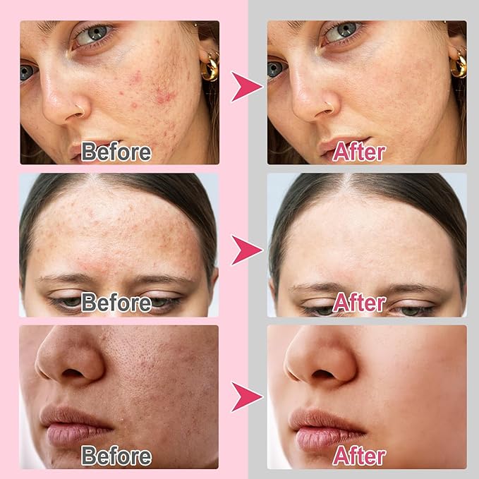 Turmeric face scrub pads, 60pcs