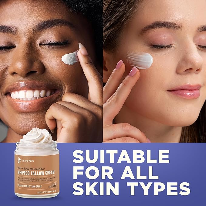 Whipped Beef Tallow for Skin - Face + Body Moisturizer, 100% Grass Fed Grass Finished Tallow and Honey Balm for Sensitive Skin - Natural Lotion - Free of Harsh Chemicals - 4oz, (Citrus Frankincense)