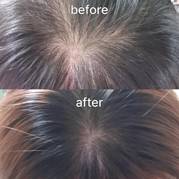 Scalp&Hair Serum for Thinning Hair by Vivelab,15ml–Clinically Tested,Nourishing Formula with Biotin,peptide. Promotes Healthy Scalp&Fuller-Looking Hair