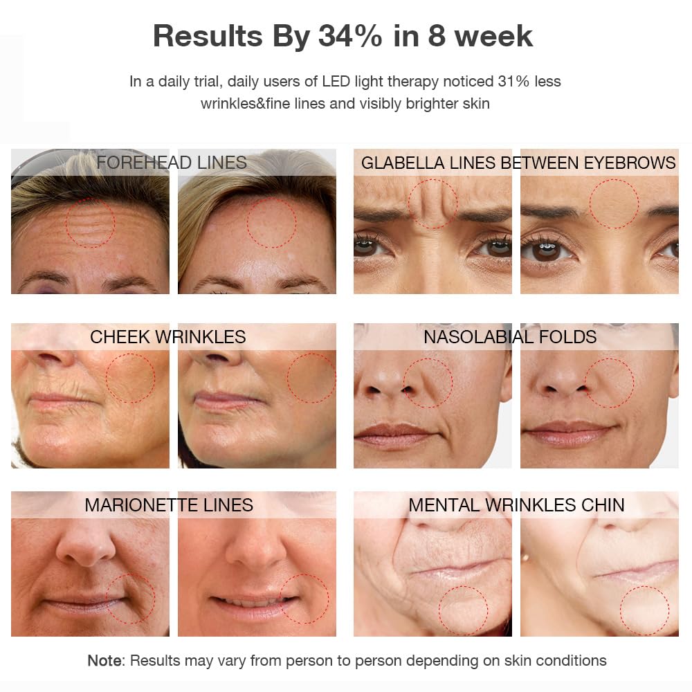 NEWKEY Red Light Therapy Mask for Face Wrinkles, 7 LED Light Therapy Facial Skin Care Mask,At-Home Photon Skin Care Beauty Mask for Anti-Ageing