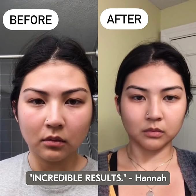 Mount Lai Rose Quartz Gua Sha Facial Tool – The Stone of Graceful Radiance – 100% Genuine Rose Quartz Stone Face Sculpting Tool for Lymphatic Drainage, Puffiness Reduction & Graceful Beauty