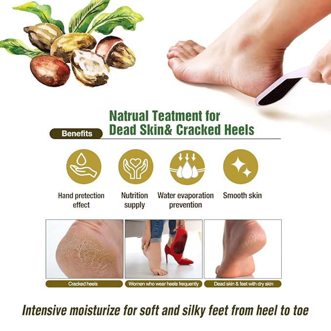 Epielle Hydrating Hand & Foot Masks 12 Pairs, Deep Moisturizing Socks & Gloves, Soften Dry Hands & Cracked Heels with Shea Butter & Jojoba Oil, Korean Skin Care, Foot Spa, Self Care Gifts for Women