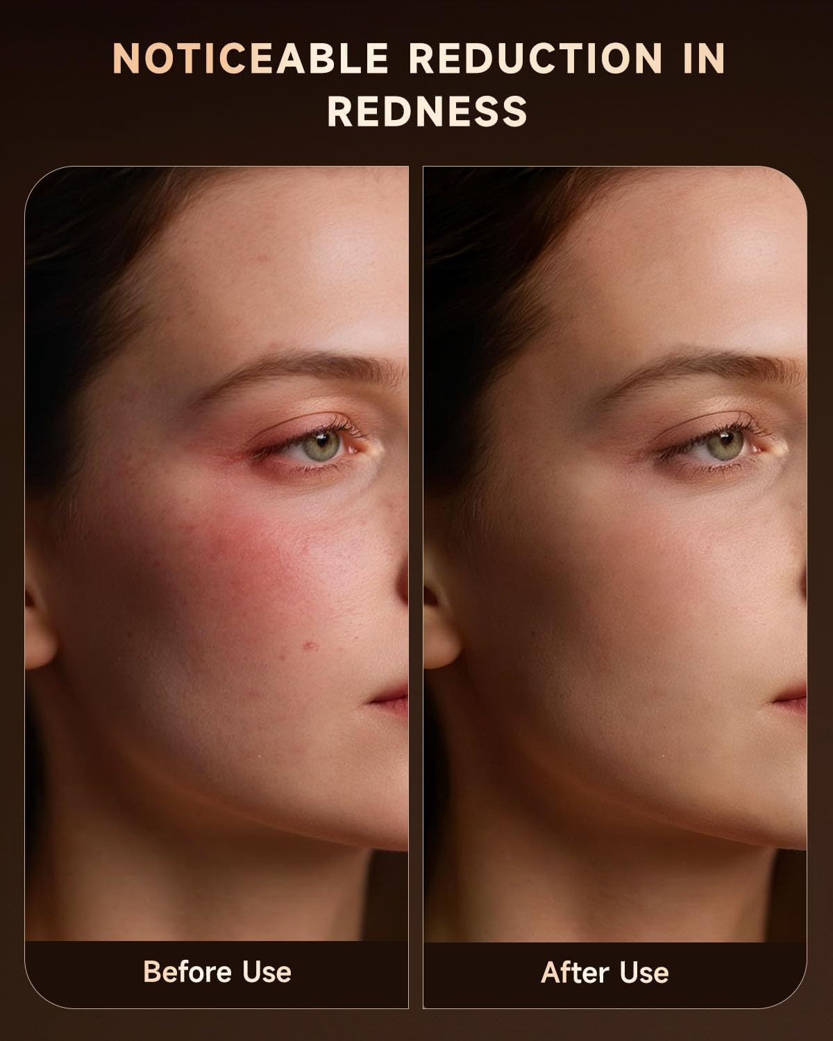 Red Light Therapy Mask for Face, 4 Modes Wireless Remote LED Face Mask Light Therapy, 850nm Near-Infrared & Red Light, 272 LEDs, Anti-Aging Skin Rejuvenation Device for Home or Travel Gift for Women