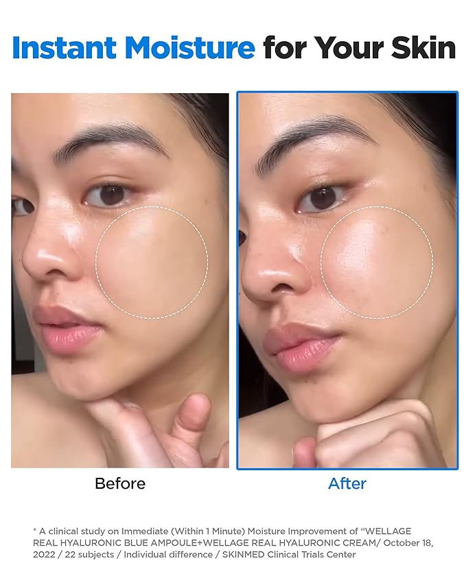 WELLAGE Real Hyaluronic Blue Ampoule 100, Fragrance Free Hyaluronic Acid Ampoule, Hydrating Non Sticky Serum for Sensitive Dry Skin, 2.54 fl.oz