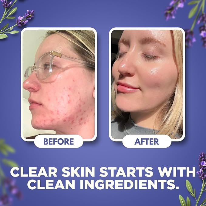 Whipped Beef Tallow for Skin - Face + Body Moisturizer, 100% Grass Fed Grass Finished Tallow and Honey Balm for Dry Skin - Natural Lotion - Free of Harsh Chemicals - 4oz, (Lavender)