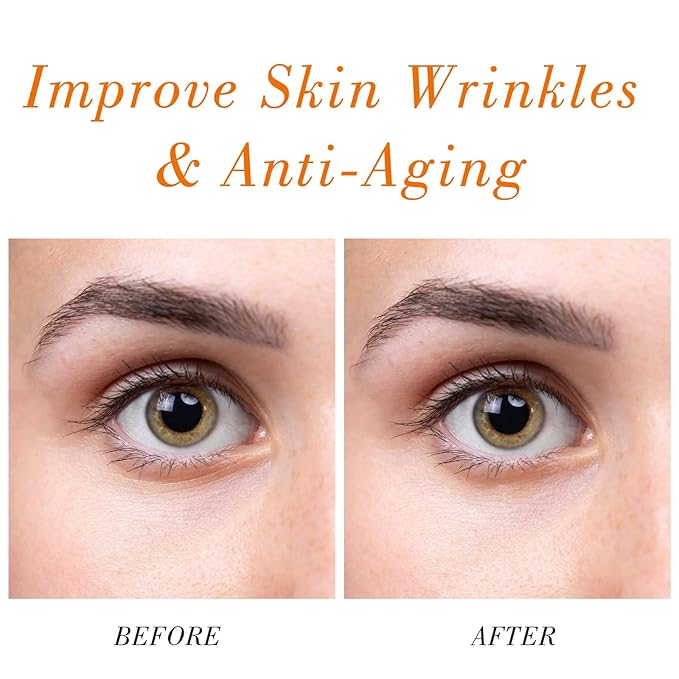 Rosehip Seed Oil for Face (2 oz/60 ml) USDA Certified Organic 100% Pure Natural Cold Pressed Unrefined Rosehip Oil for Skin Anti-Aging, Scar, Hair Moisturizer, Gua Sha Massage, Nails