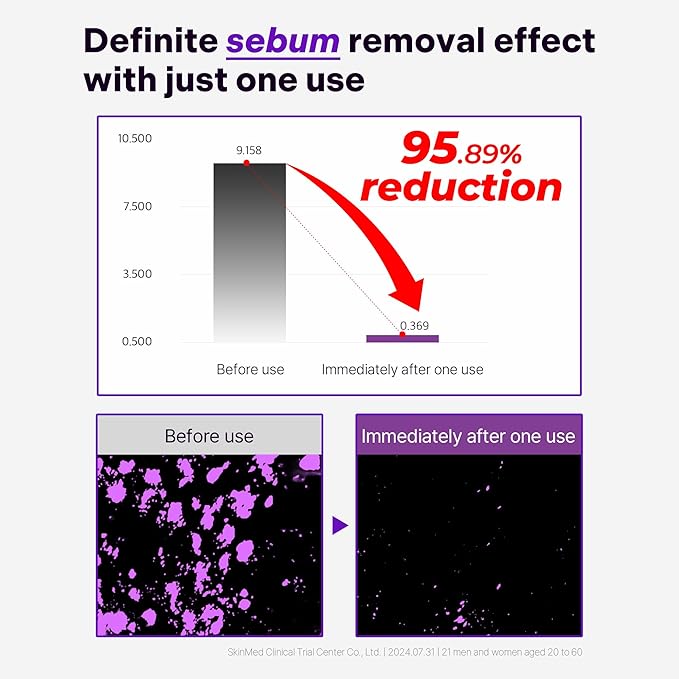 ALIVELAB O2 Scalp Water Shampoo for Sensitive Scalp, Itchy, Anti Dandruff, Deep Cleansing and Soothing, Hair Care, Scalp cleanser, Water Type, Liquid shampoo, Silicone-Free 11.38 fl oz