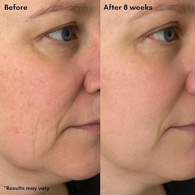 Vitamin C Brilliant Glow Face Serum – Korean Anti Aging Skincare with THD Ascorbate, Matrixyl 3000, Ferulic Acid & Ginseng – Visibly Reduces Dark Spots, Uneven Tone, Fine Lines & Wrinkles