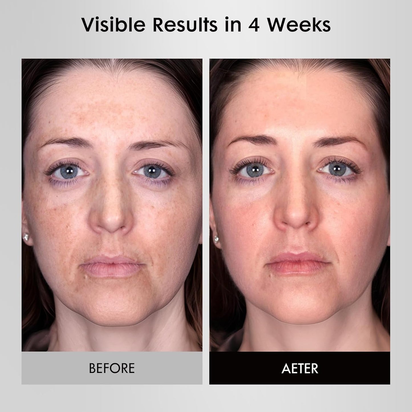 LED Face Mask Light Therapy, FDA-Cleared, 4 Modes Red Light Therapy for Face with Remote and Timer, 2000mAh Rechargeable, Blue, 850NM Infrared & Red Light Therapy Mask at Home, 288 LEDs, White