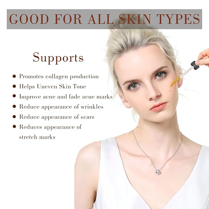 100% Pure Natural Rosehip Oil for Face, USDA Certified Organic, Cold Pressed, Extra Virgin, Hexane Free Rosehip Seed Oil for Anti-Aging, Acne Scar Treatment, Skin & Hair Care (4.22 oz/125 ml)