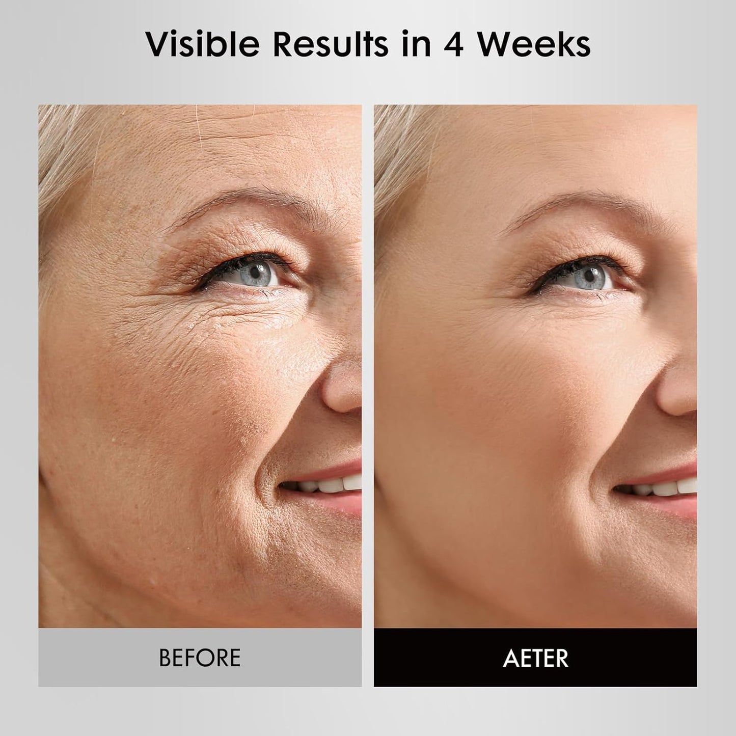 LED Face Mask Light Therapy, FDA-Cleared, 4 Modes Red Light Therapy for Face with Remote and Timer, 2000mAh Rechargeable, Blue, 850NM Infrared & Red Light Therapy Mask at Home, 288 LEDs, White