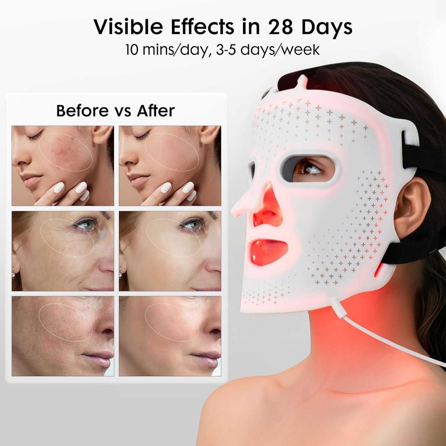 LED Face Mask Light Therapy, FDA-Cleared, 4 Modes Red Light Therapy for Face with Remote and Timer, 2000mAh Rechargeable, Blue, 850NM Infrared & Red Light Therapy Mask at Home, 288 LEDs, White