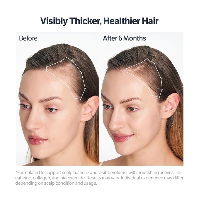 SUNGBOON EDITOR Deep Collagen Retinol Power Boosting Scalp Serum | Roll On Hair Growth, Hair Thickening Serum, Itchy & Dry Scalp Treatment, Caffeine, Biotin, Rosemary – Korean Hair Care, 0.5 fl oz