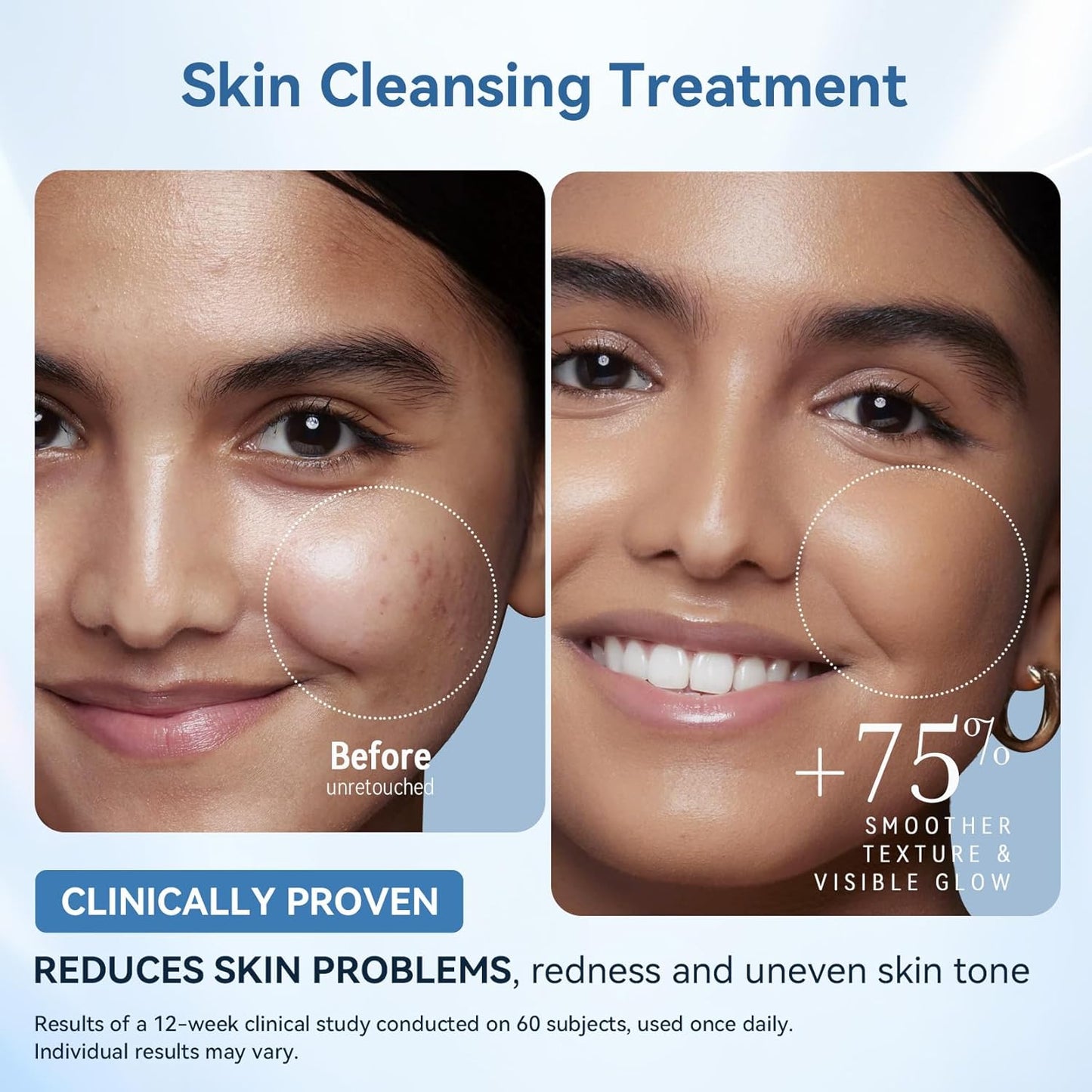 FOLOKE LED Light Therapy Mask Skin Care Mask, LED Red 630±5nm & NIR 830nm Wavelength for Home Use