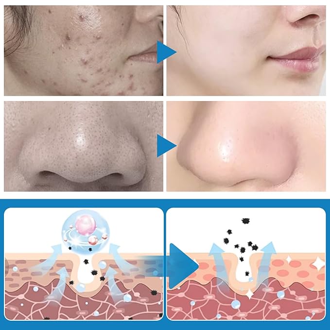 Turmeric kojic acid cleansing pads,