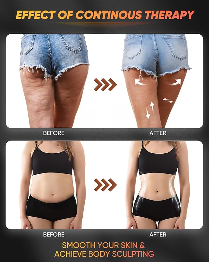 ONUEMP 5-in-1 Stainless Steel Therapy Massage Tools, Gua Sha Scraping Fascia Massage, Maderoterapia Kit Colombiana for Lymphatic Drainage, Cellulite Remover, Ice Body Sculpting