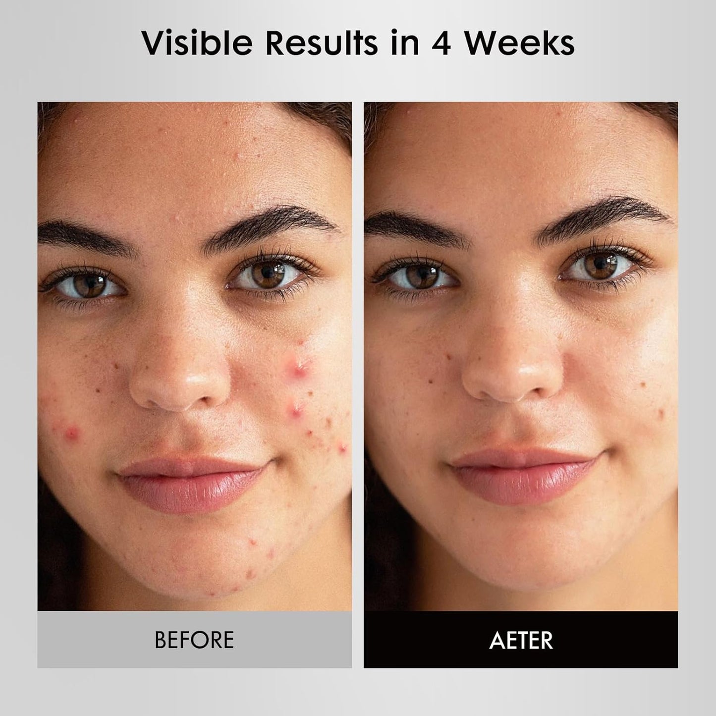 LED Face Mask Light Therapy, FDA-Cleared, 4 Modes Red Light Therapy for Face with Remote and Timer, 2000mAh Rechargeable, Blue, 850NM Infrared & Red Light Therapy Mask at Home, 288 LEDs, White