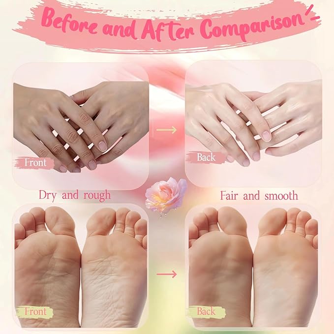 Paraffin Treatment Gloves, Paraffin Wax Gloves, Healing Softening Skin Wax Caring Treatment Mask for Hand Feet, 2 Pair Paraffin Waxing Hand Gloves & 2 Pair Paraffin Wax Foot Covers,Rose