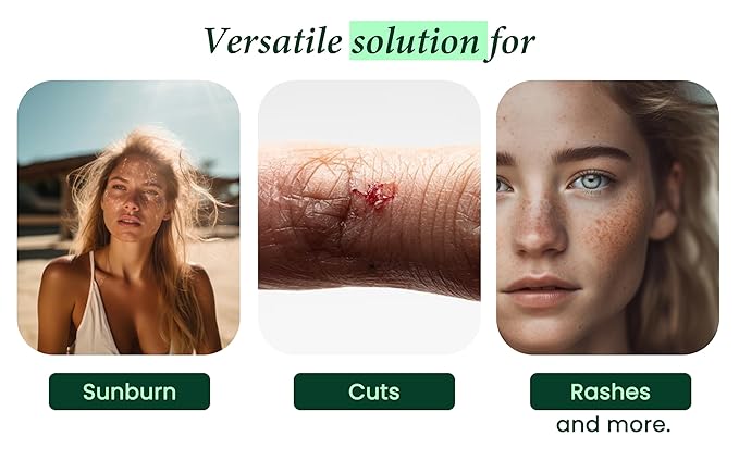 100% Pure & Organic Aloe Vera Spray, Clinically tested & Dermatologist approved, Hydrates & Heals Dry & Damaged Skin & Hair- 12 Oz