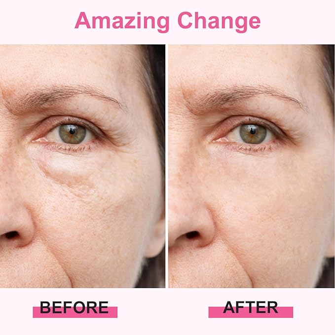 Ice Roller for Face Body, Hot Roller Ice Rollers, Facial Roller Skin Care Tool for De-puffing Soothing Face for All Skin Types, Premium Silicone Handle, Gift for Women Girls, Pink, 1 PCS