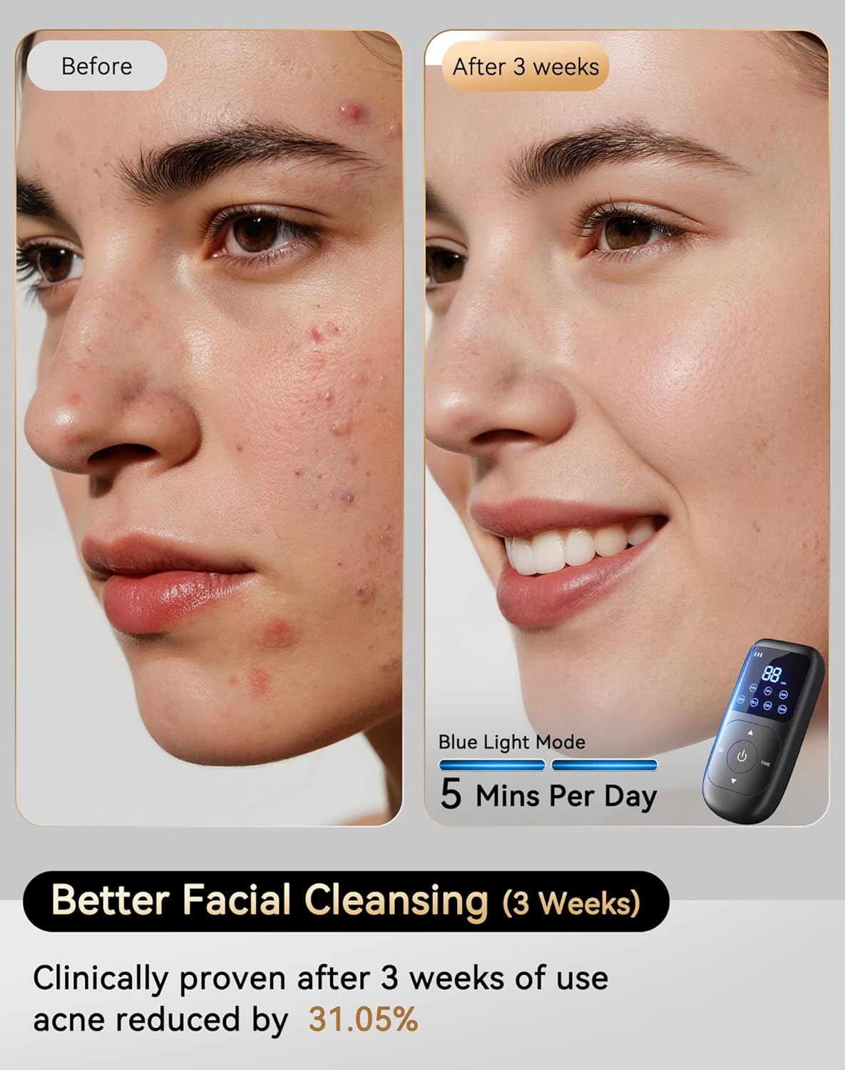 LED Light Therapy Mask, 4D LED Face Mask Light Therapy - 4 Modes Face Mask Light Therapy, 850nm Infrared & Red Light Masks, 4000mAh Rechargeable - Light Therapy Skin Care, Home Use