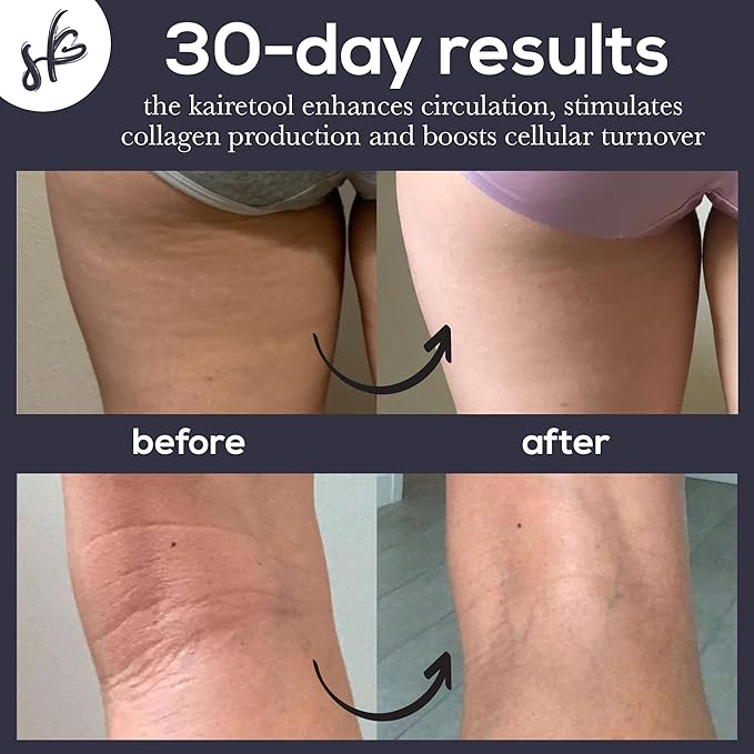 Kairetool Face & Body Massager, Lymphatic Drainage, Deep Tissue Massage, Pressure Point Therapy for Depuffing/Debloating, Fascia and Myofascial Release, Reduces Look of Cellulite, Mirror