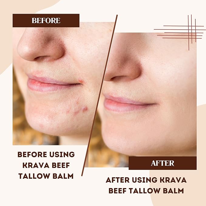 Whipped 100% Grass Fed Beef Tallow Balm – Lavender – 2 oz | Moisturizing Face & Body Cream | Natural Skincare for Dry, Sensitive Skin | Includes Bamboo Scoop