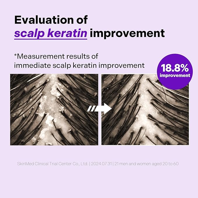 ALIVELAB O2 Scalp Water Shampoo for Sensitive Scalp, Itchy, Anti Dandruff, Deep Cleansing and Soothing, Hair Care, Scalp cleanser, Water Type, Liquid shampoo, Silicone-Free 11.38 fl oz