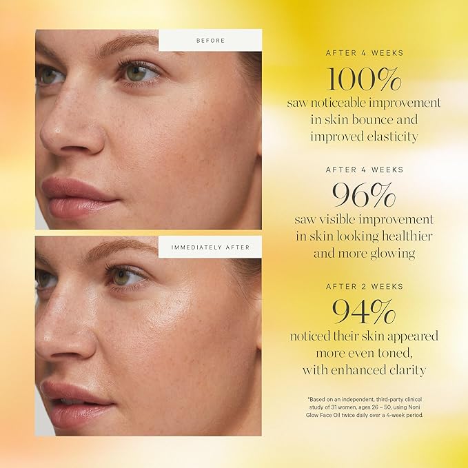 KORA Organics Noni Glow Hydrating Face Oil with Rosehip, Gua Sha Oil, Certified Organic, Cruelty Free, 0.34 fl oz - Face Care Beauty Products for Women