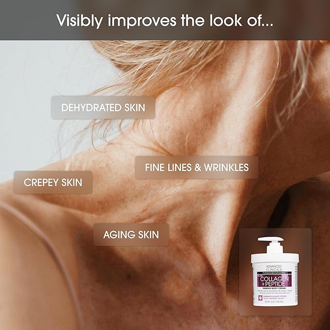 Advanced Clinicals Collagen Peptides Body Lotion & Face Moisturizer | Peptide Infused Collagen Lotion For Women & Men Helps Improve Look Of Crepey Skin, Wrinkles, & Uneven Dry Skin Texture, 16 Ounce