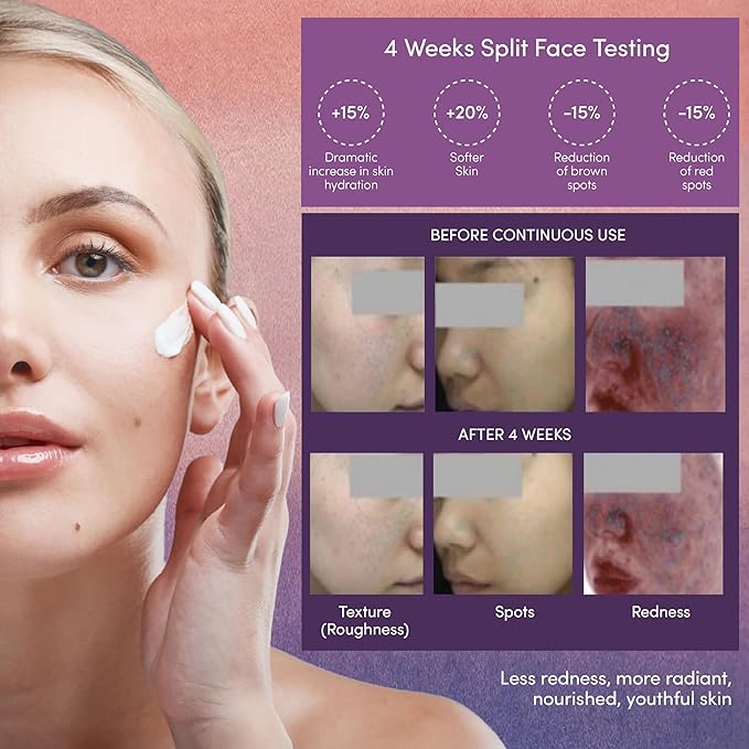 YUNI | Niacinamide Moisturizer | Collagen Boosting Face Cream | 5% Niacinamide | For Sensitive Skin | Anti-Aging Skincare | Skin Tightening | Plant Based | Vegan Skincare | 1.7 oz