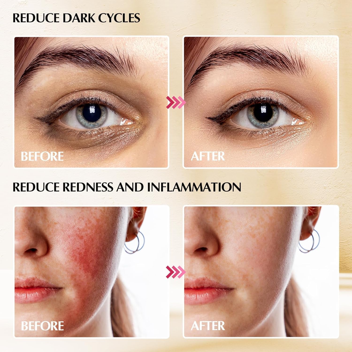 2-In-1 Gua Sha Cryo Sticks, Facial Skin Care Tools for Women Face and Eyes Massage, Unbreakable Stainless Steel Esthetician Supplies, Cooling Spa Ice Globes Roller with Carry Case